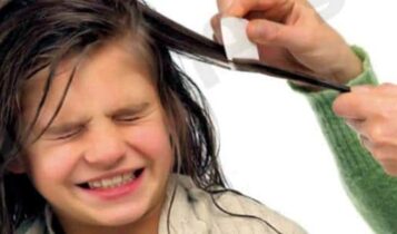 طرق التخلص من قمل الشعر للأطفال