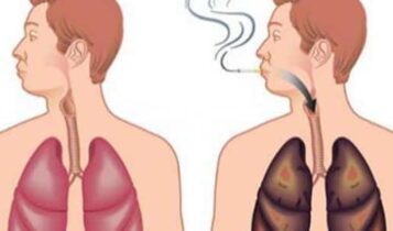 تنظيف الرئتين من آثار التدخين
