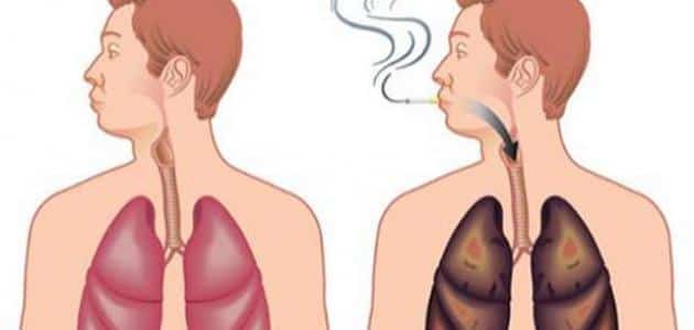 تنظيف الرئتين من آثار التدخين