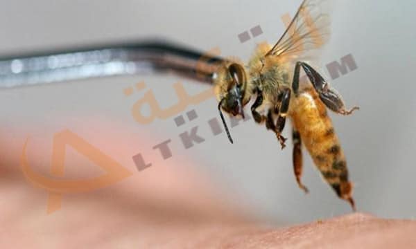 فوائد العلاج بسم النحل