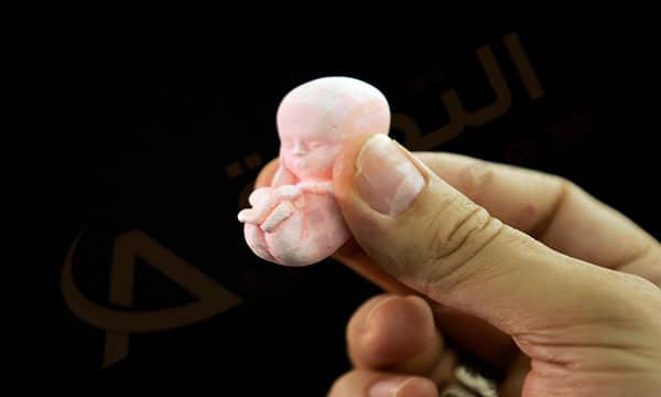أسباب سقوط الحمل