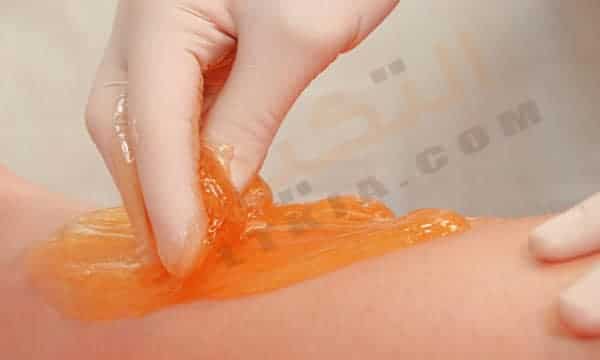إزالة الشعر الزائد