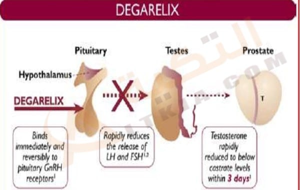 ديجاريليكس