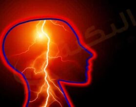 الصرع عند الأطفال
