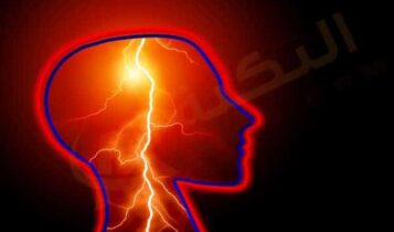 الصرع عند الأطفال