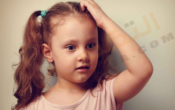 تساقط الشعر عند الأطفال