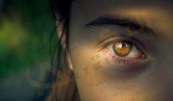ارتخاء عضلات العين