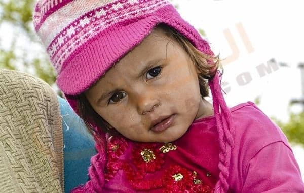 جدري الماء عند الأطفال