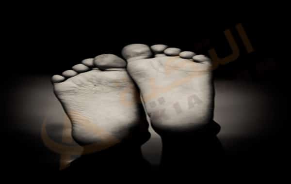 تشققات القدم