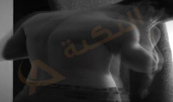 تشنج عضلات الظهر 