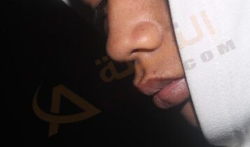 حساسية الجيوب الأنفية