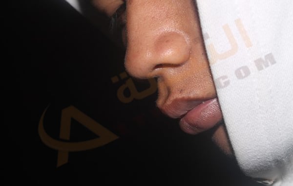 حساسية الجيوب الأنفية