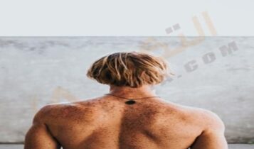 داء المبيضات