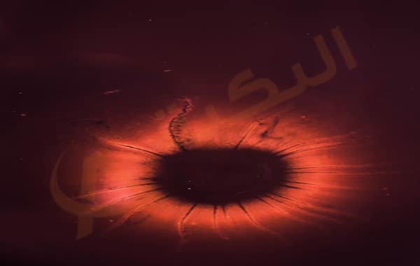 تعفن الدم
