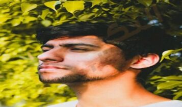 حموضة الحلق