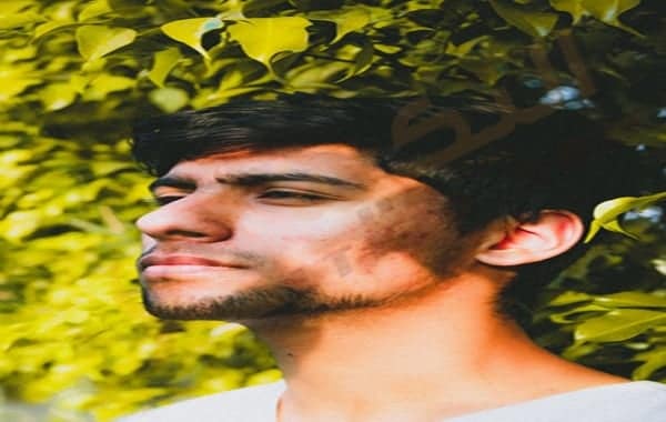 حموضة الحلق