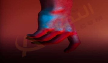 ألم مفصل اليد