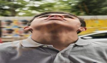 خمول الغدة الدرقية