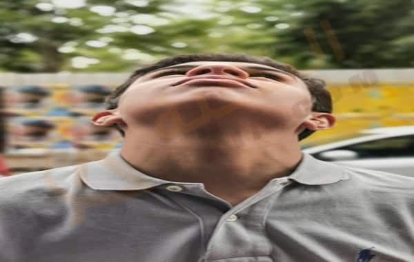 خمول الغدة الدرقية