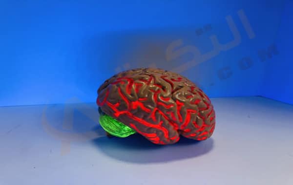 الرجة الدماغية