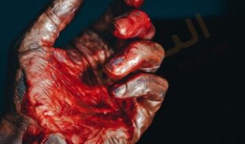 تسلخ الاوعية الدموية