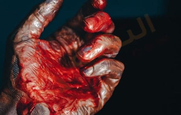 تسلخ الاوعية الدموية
