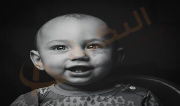 صديد العين
