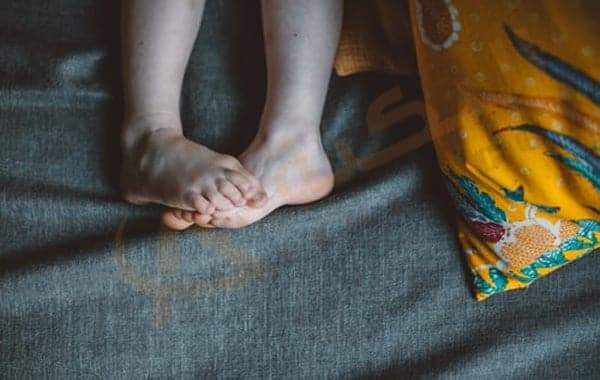 التهاب اللفافة الأخمصية