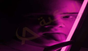 التهاب الغدد اللعابية 