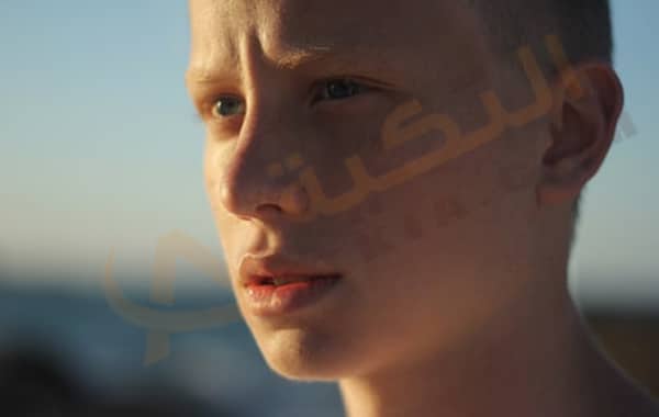 سيلان الأنف