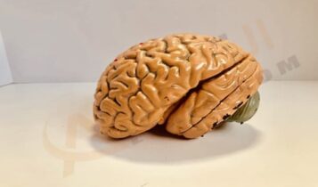 ورم المخ