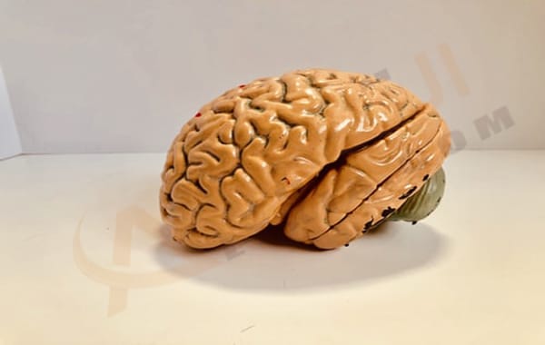 ورم المخ