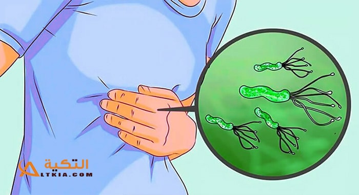 علاج جرثومة المعدة