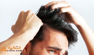 علاج حكة الرأس