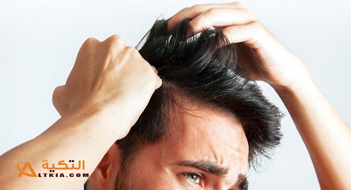 علاج حكة الرأس