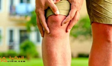 علاج الروماتيزم بالأعشاب