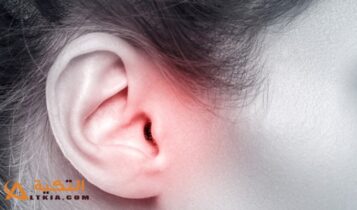 علاج التهاب الأذن الداخلية بالأعشاب