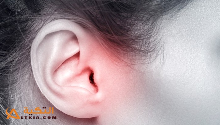 علاج التهاب الأذن الداخلية بالأعشاب