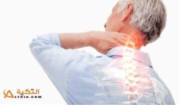 تشنج عضلات الرقبة