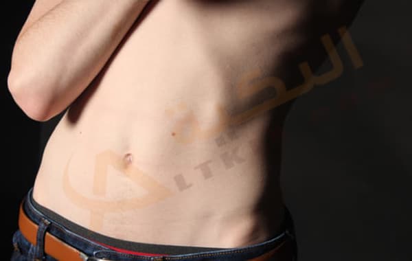 غازات واضطرابات البطن