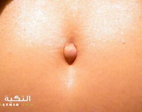 شلع السرة
