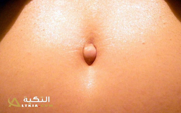 شلع السرة