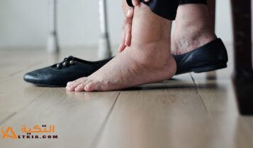 علاج تورم القدمين
