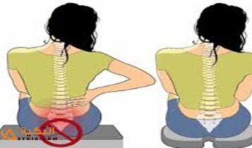 علاج ألم العصعص