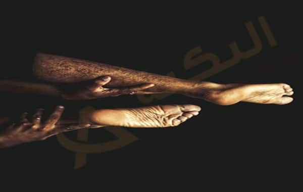 تشقق الكعبين