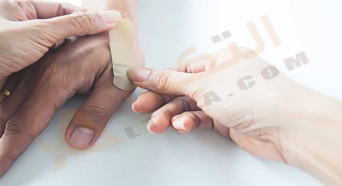 تفسير رؤية الميت مجروح في المنام