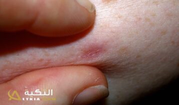 الحبوب في اليدين في المنام