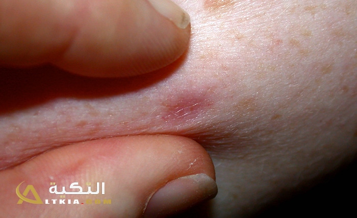 الحبوب في اليدين في المنام