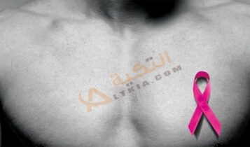 أعراض سرطان الثدي عند الرجال