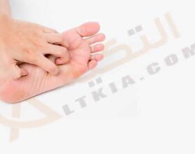 علاج حكة باطن القدم بالأعشاب